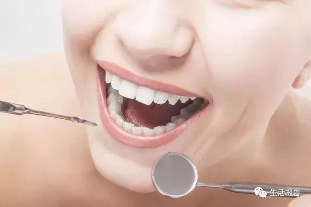 冲牙器水牙线实测,水牙线冲牙器品牌哪个好用