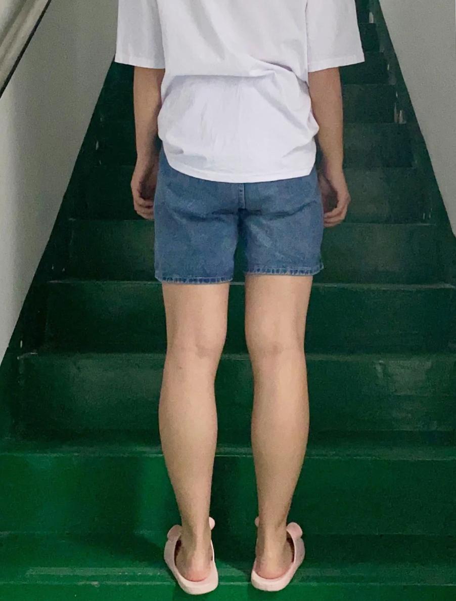 今年最流行遮肉款超显瘦,夏季露肉显瘦