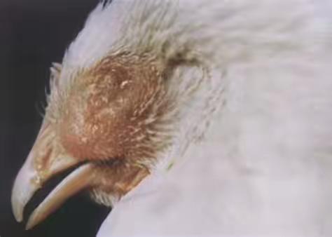 鸡眼睛肿流泪的原因你了解吗？鸡眼肿流泪怎么治？