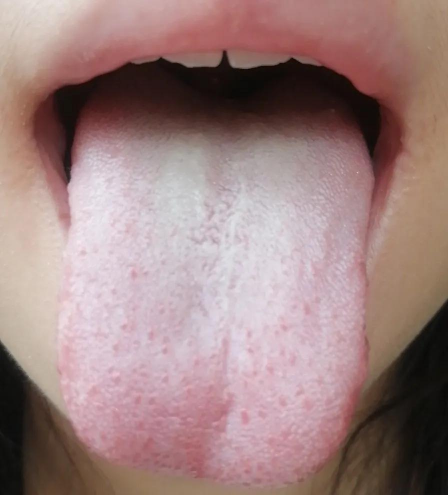 七宝美髯丹是治掉头发吗,掉头发吃七宝美髯丹管用吗