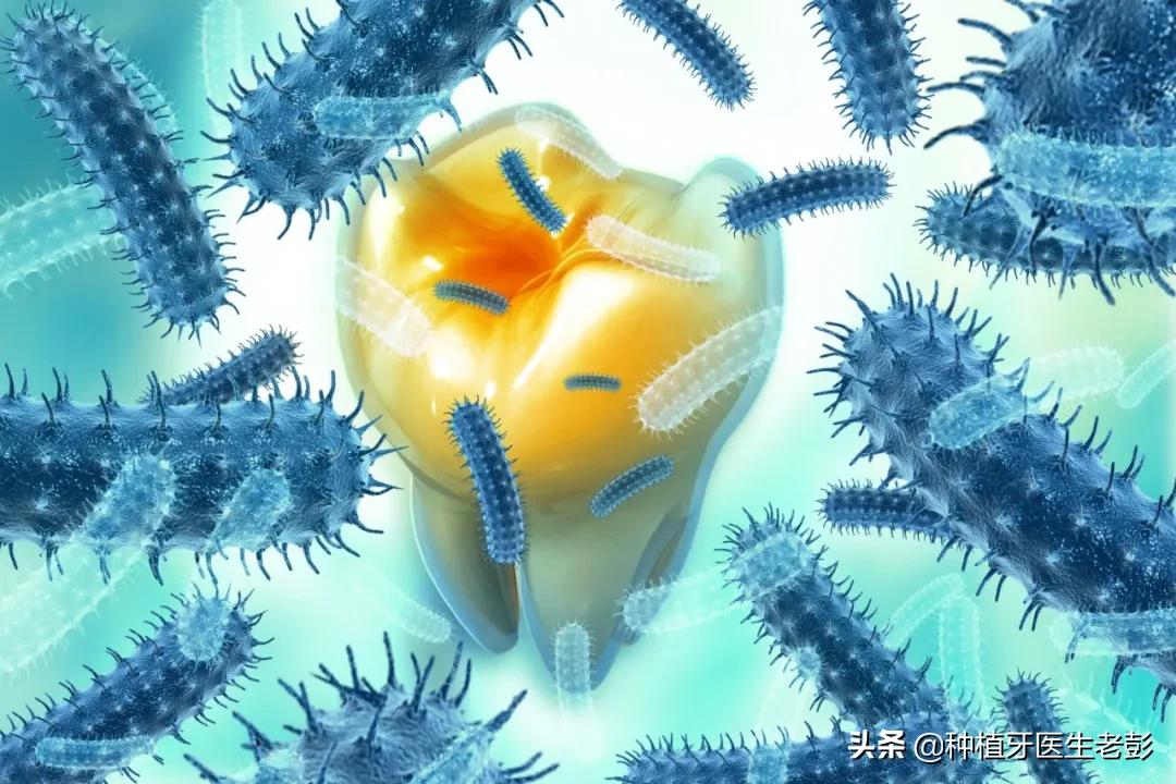 智齿发炎真是疼啊,为什么智齿发炎了会反反复复