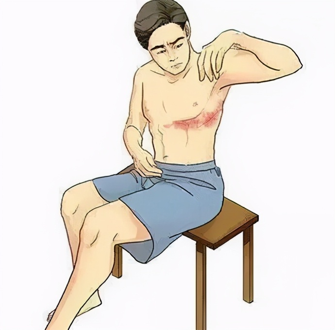 带状疱疹错过最佳治疗时期,带状疱疹是个大隐患早认识早治疗