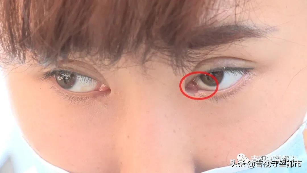 美甲店里做坏“双眼皮”，“名医”、店主全失联了…