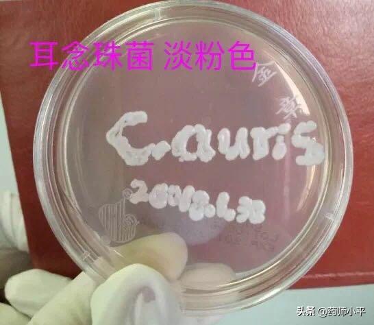 耳念珠菌会死吗,耳念珠菌美国有多少病例