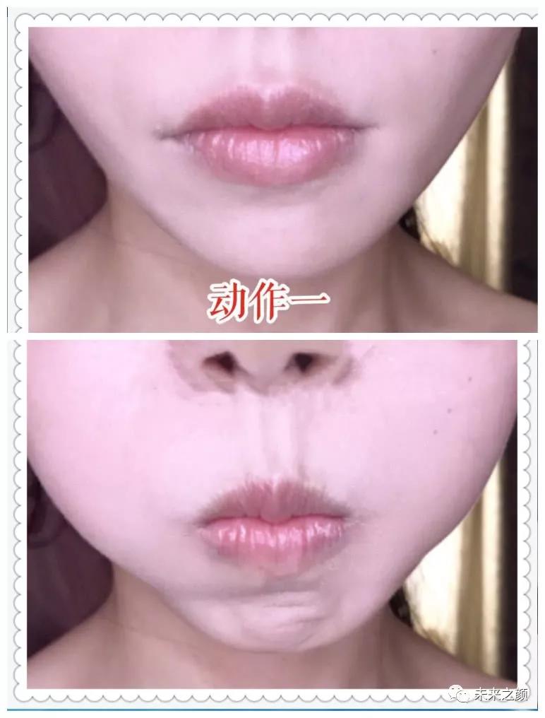 脸部做什么操祛除法令纹,面部瑜伽操改善法令纹抖音小游戏