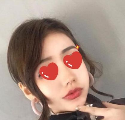 宽大又不对称脸型，被颧弓内推成功“拯救”