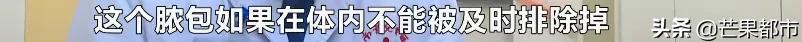 儿童手肘摔伤了一直骨头尖疼,儿童摔伤之后发烧是为什么
