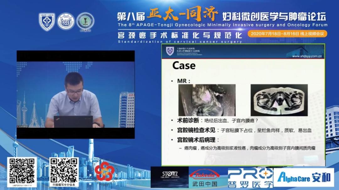 扬鞭策马，英姿飒爽,4—第八届亚太同济妇科微创论坛手术展播