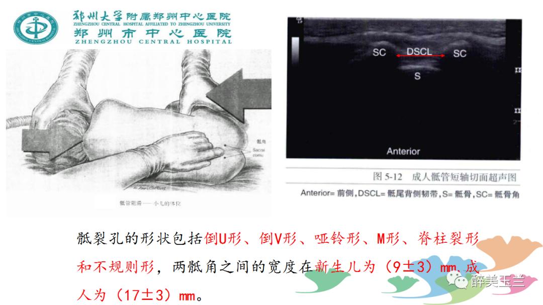 局麻药中毒的术前用药口诀,局麻药中毒临床表现及处理流程ppt