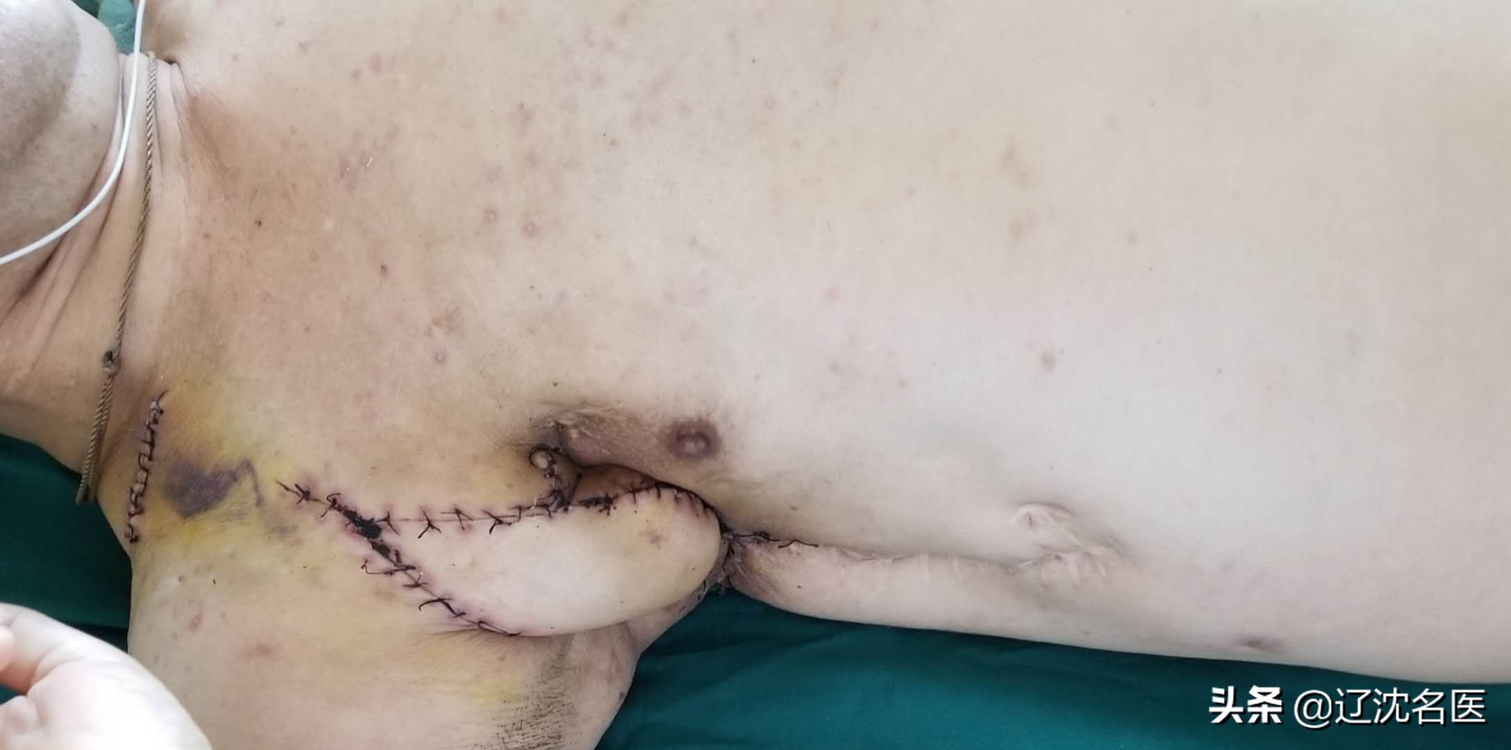 男人被病痛折磨20年,男子被病魔折磨10年