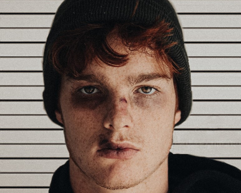 去黑眼圈小妙招在家就可以做,祛黑眼圈的家庭小妙招