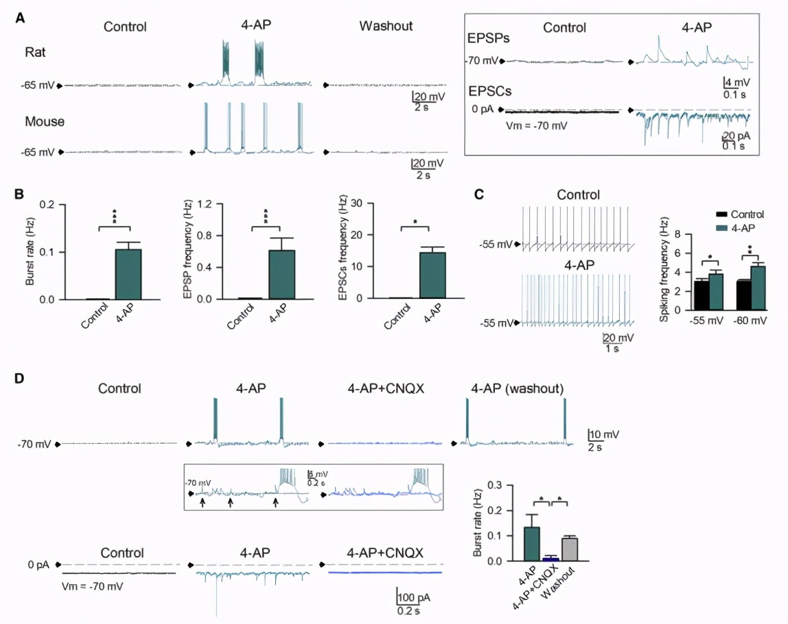 帕金森患者典型的震颤,帕金森病震颤的神经环路机制