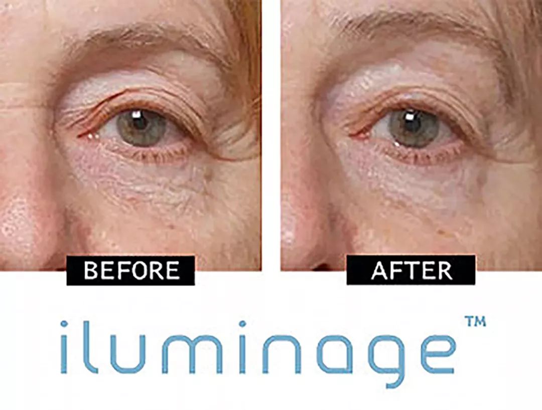 脱发为什么会丑,原来你的头发是这样长出来的