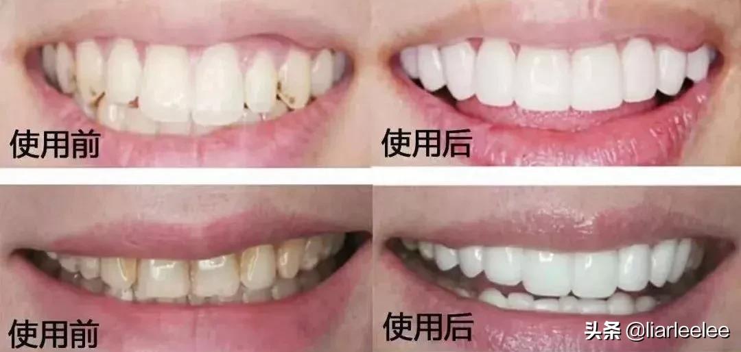 最好用的牙膏排行榜前十名,选哪个牌子的牙膏最安全好用