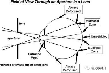 有什么办法能去掉黄斑,怎样去掉眼角黄斑