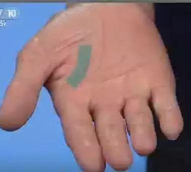 手诊10种常见病从手上就能看出来,手上健康的秘密