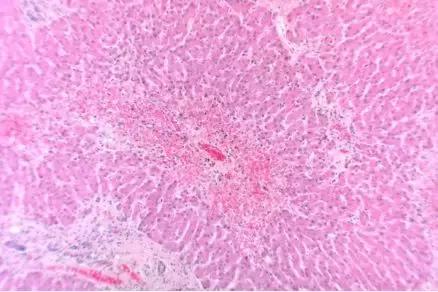 水蛭一般会吸人血吗,水蛭会吸光人血吗