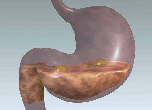 奶牛魏氏梭菌主要症状,育肥牛瘤胃发病原因