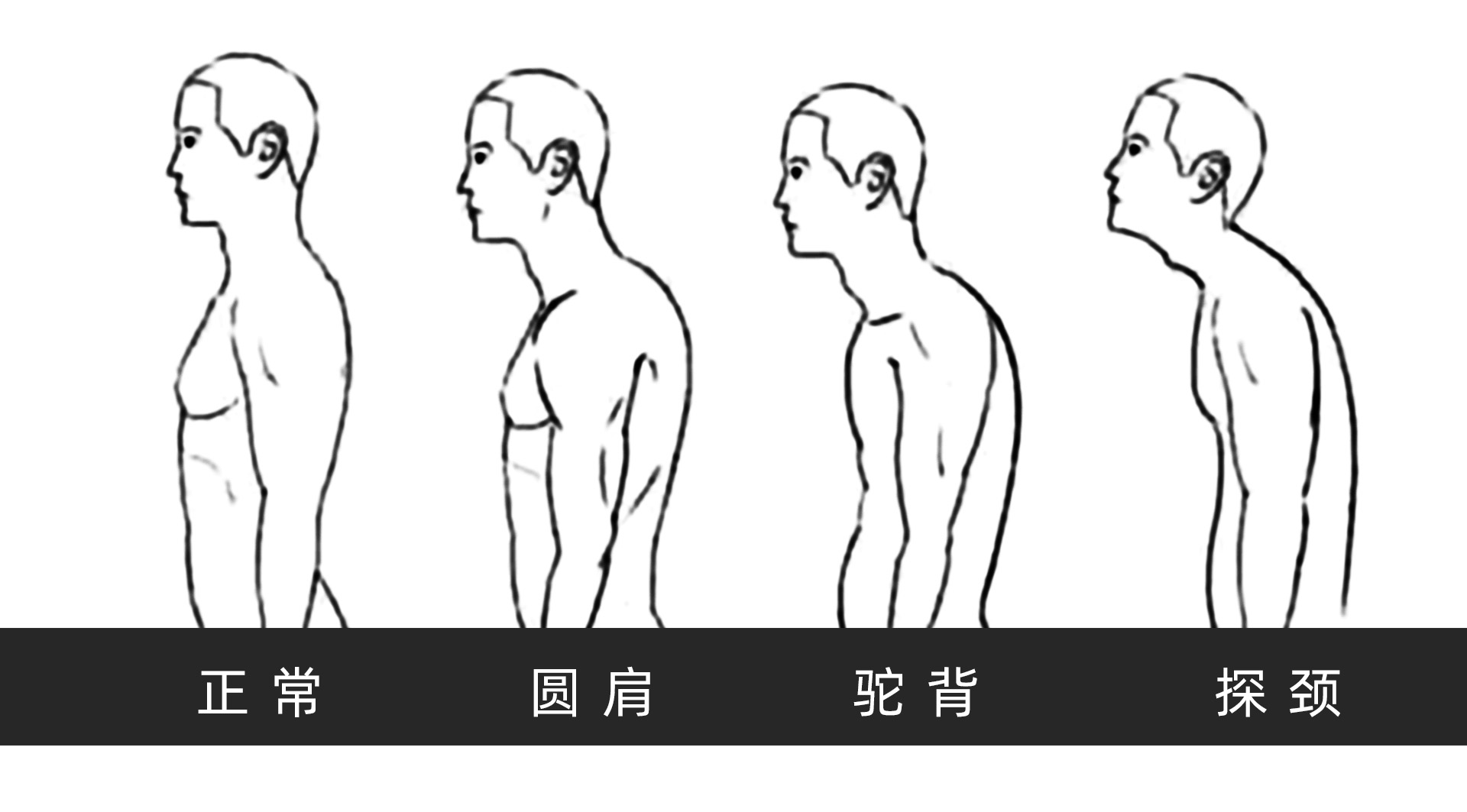 脑供血不足颈肩酸痛自我锻炼,颈肩酸痛吃双氯芬酸钠有效吗