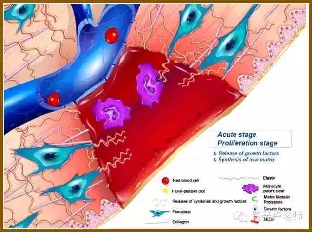 肛肠外科手术伤口护理,肛肠手术伤口换药用什么药好