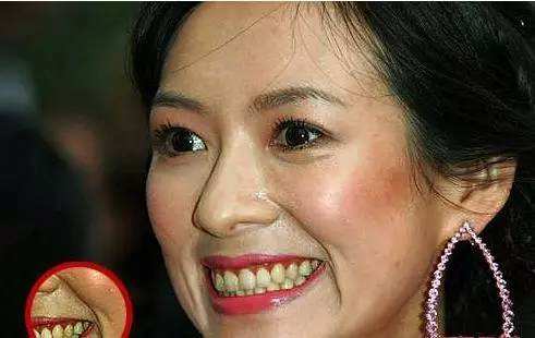 牙黄口臭怎么办用什么牙膏,黄牙口臭解决方法牙膏