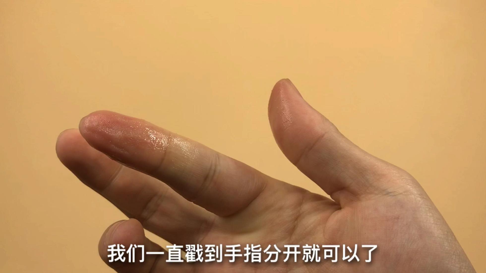 502把手指和木棍粘在一起怎么办,手指被502粘住再滴一滴502可以吗