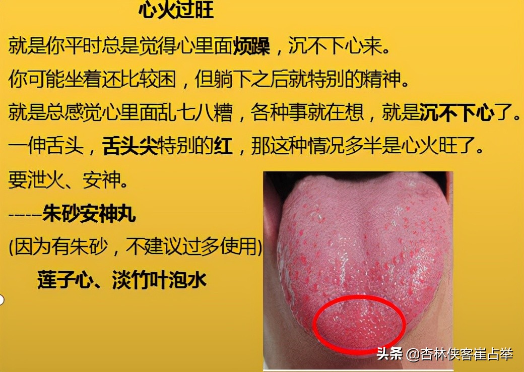 治疗失眠的十种中成药,治疗失眠多梦的中成药大全