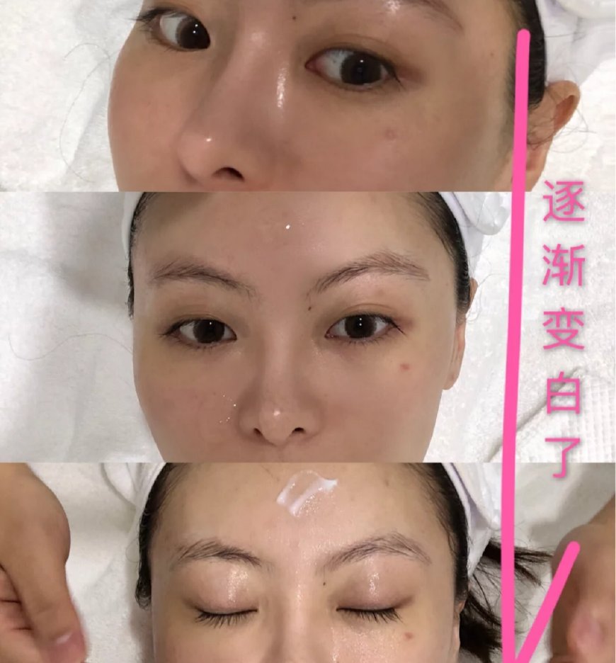 韩国人皮肤好是气候的原因,韩国人皮肤好是为什么