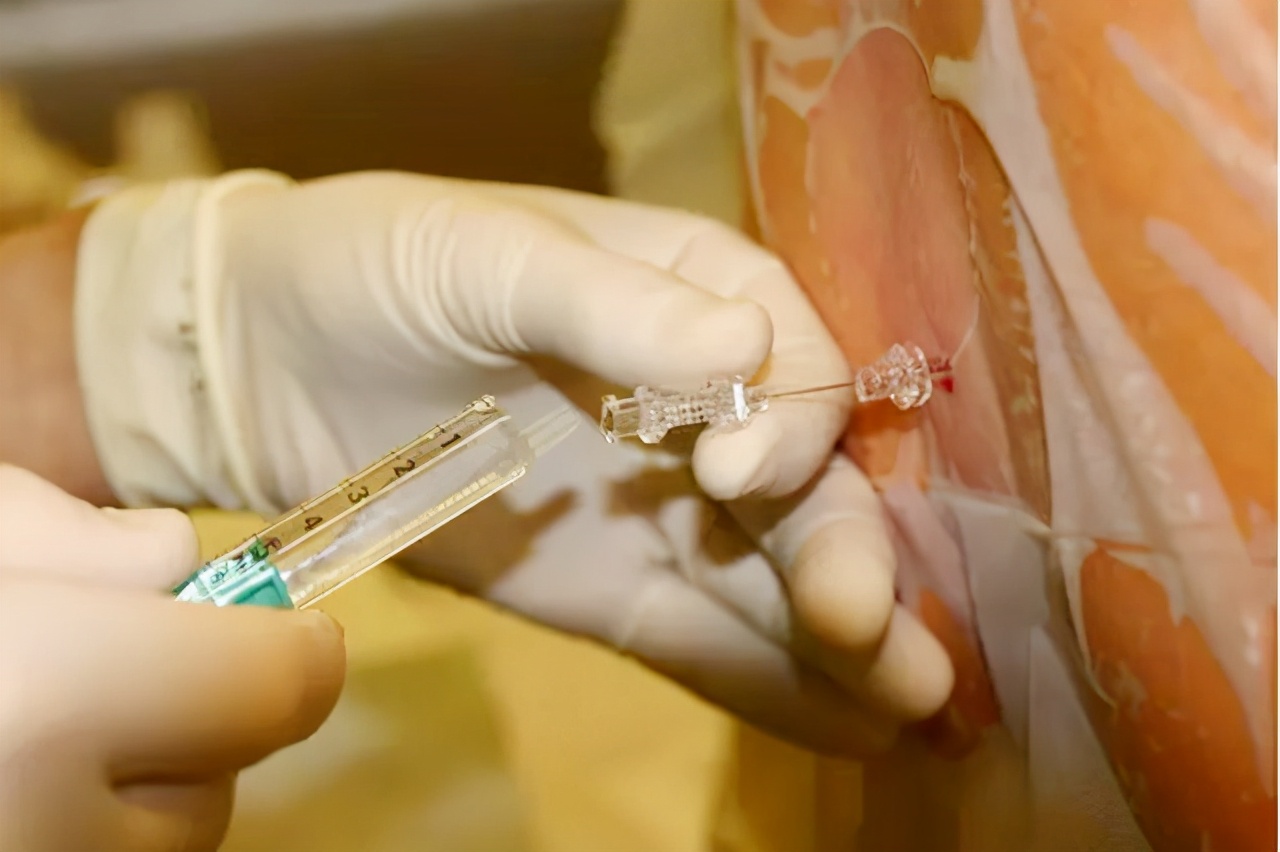 历史上梅毒,梅毒的来源历史