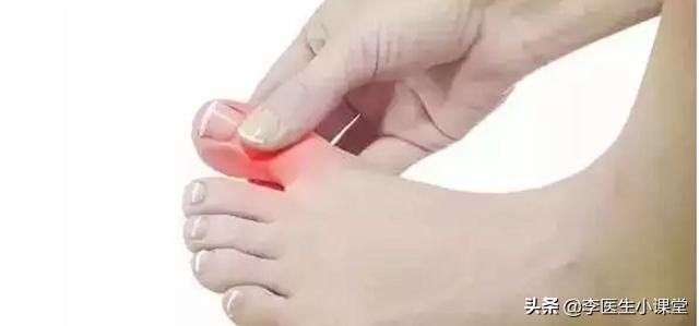 维c与叶酸先吃哪个,叶酸d3维生素c怎么吃