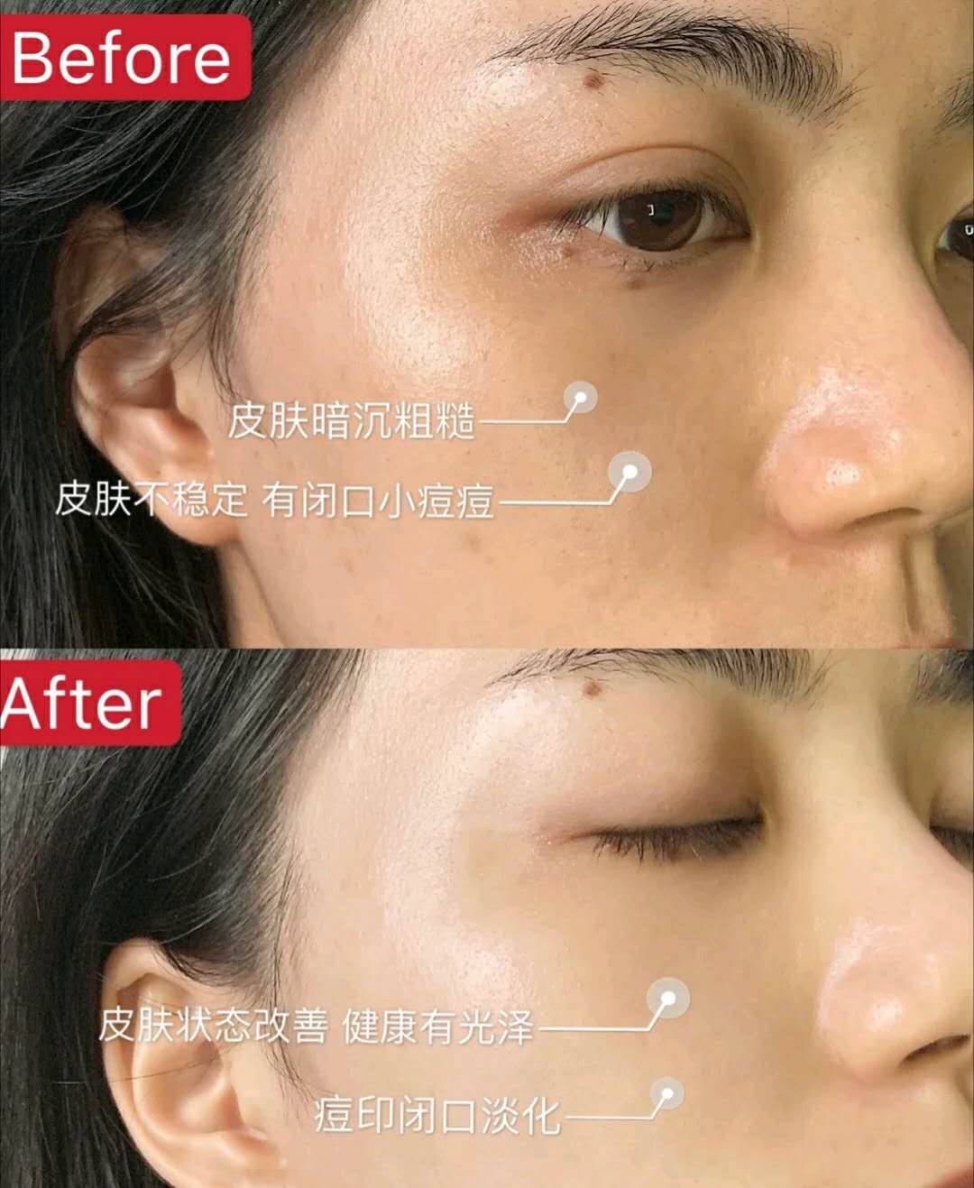 精华液的涂抹正确方法,涂抹精华液的正确方法