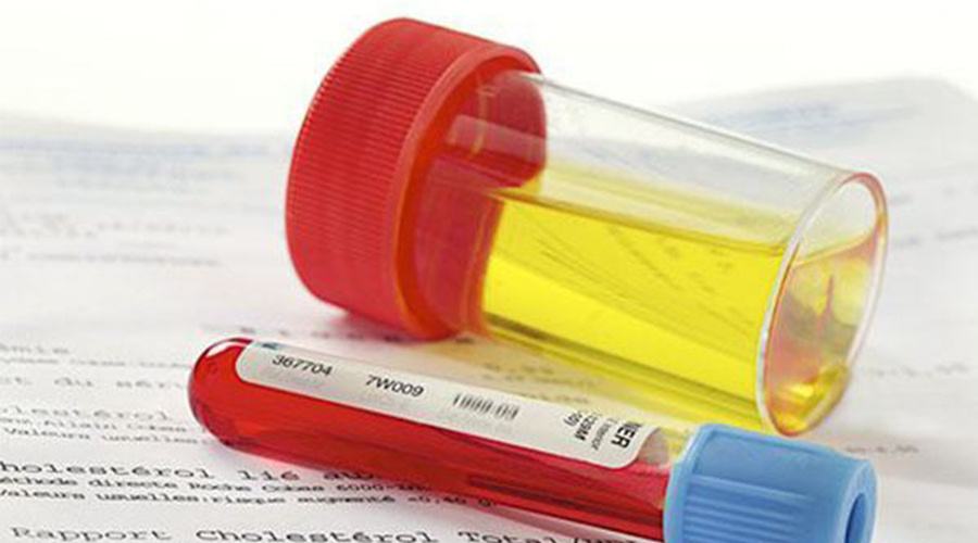 血尿是不是就是尿常规里有潜血,血尿就是红细胞高吗