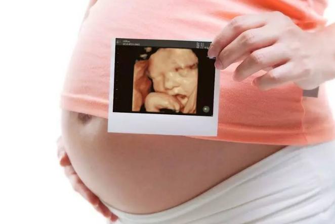 做四维彩超前孕妇要注意什么,做四维彩超孕妇需要注意什么
