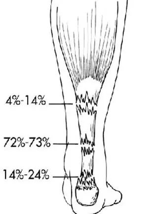 杜兰特和汤普森受伤视频,伤病猛于虎是什么意思