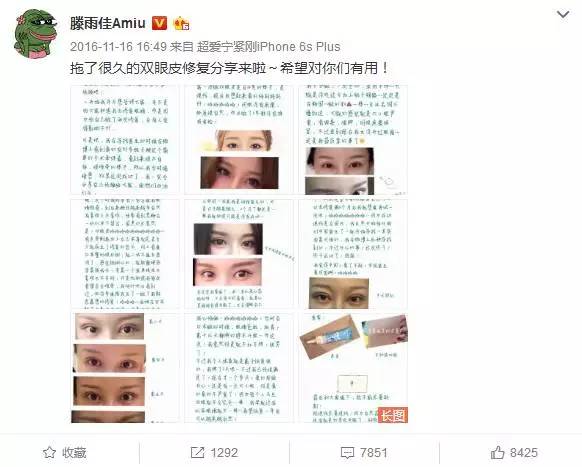 把水光针当饭吃?这位网红简直丧心病狂!整容后年入千万