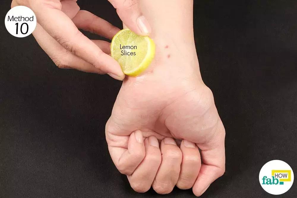 宝宝被蚊子咬了怎么消肿止痒最快,被蚊子咬了怎么止痒消肿用什么药