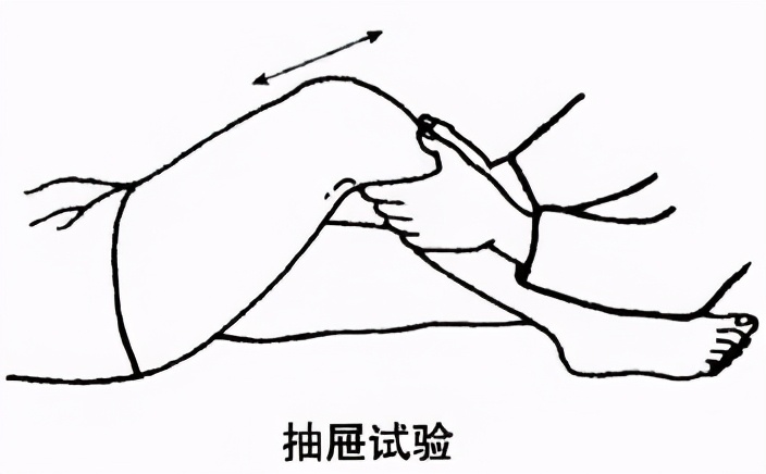 前交叉韧带断裂手术费用大概多少,前交叉韧带断裂重建手术最佳时间