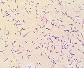 养殖菌菇需要什么条件,养殖菌和种植菌区别