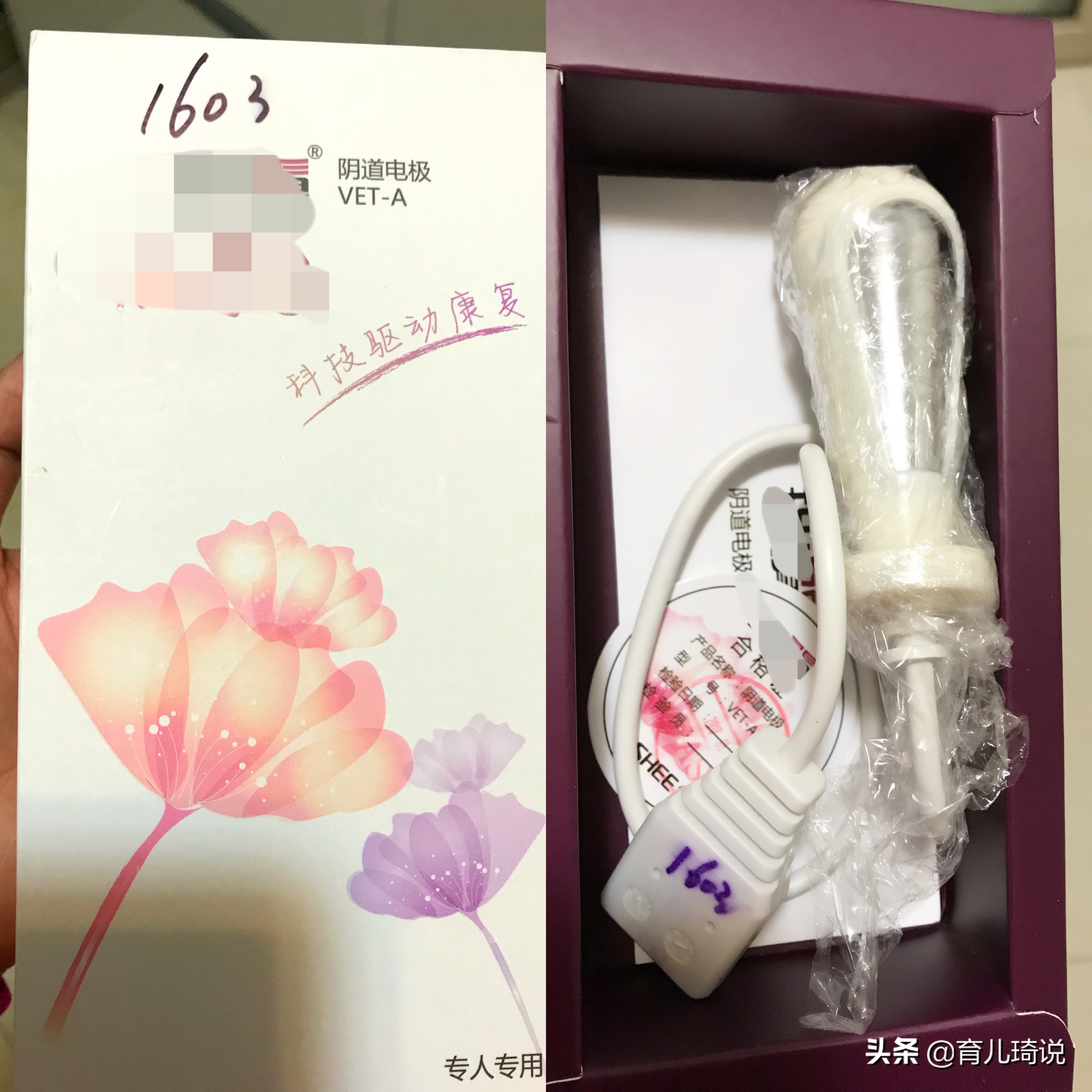 产后下垂要做盆底肌修复吗,产后真的要做盆底肌修复吗