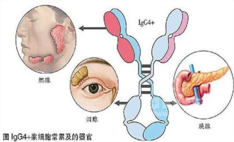 “东方美女”也是病？严重能夺命