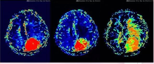 核磁共振能看出来哪些病症,核磁共振可以检查良恶性吗