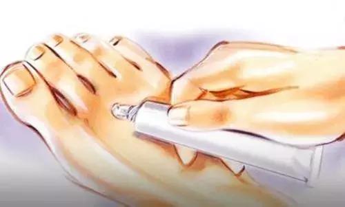 小小脚气危害大，春季正高发，孕妈中招能用药吗？