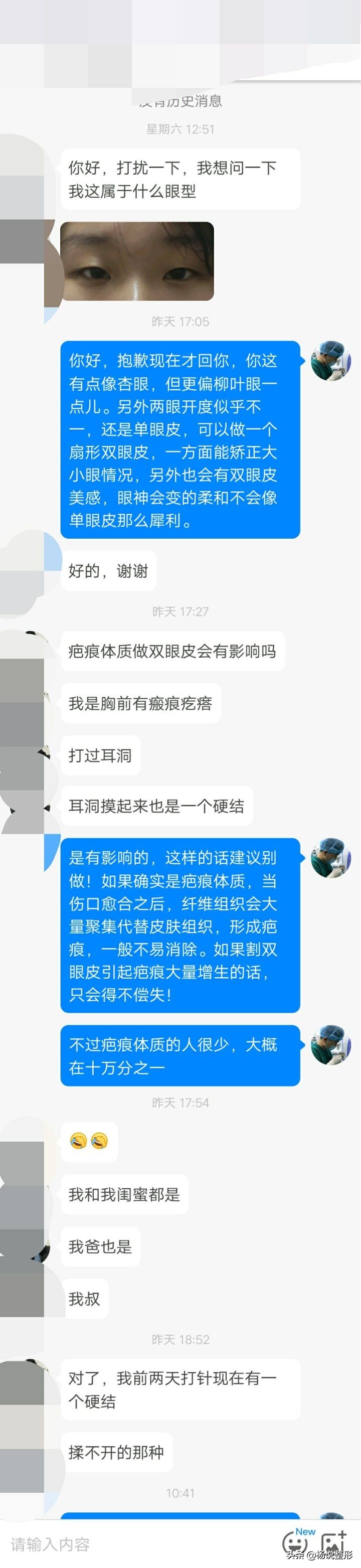 整形医生科普割双眼皮必看攻略,割双眼皮一定好看吗