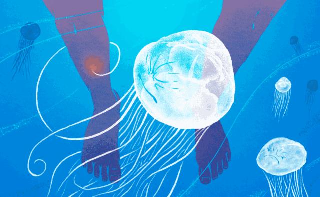 被水母蜇伤后浑身疼痛怎么办,预防水母蜇伤的最佳方法