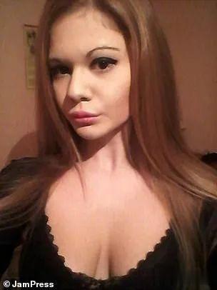 20次整容成功的女人,22岁女人做20次丰唇手术