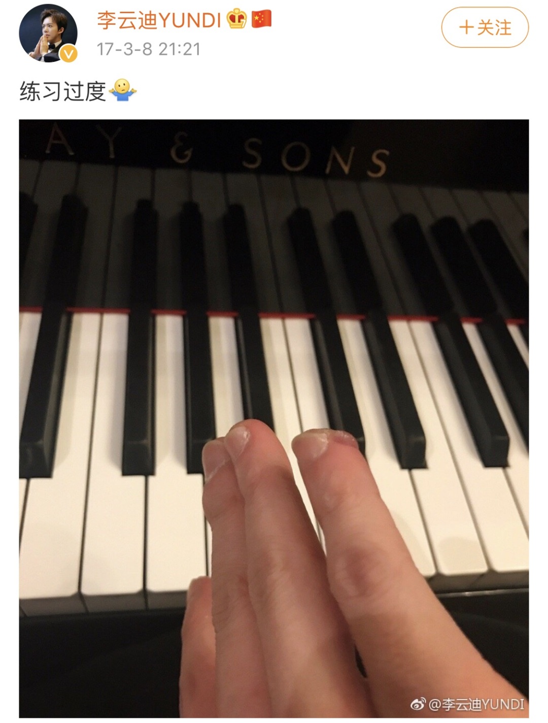 再继续这样弹琴,你的手就要“烂了”