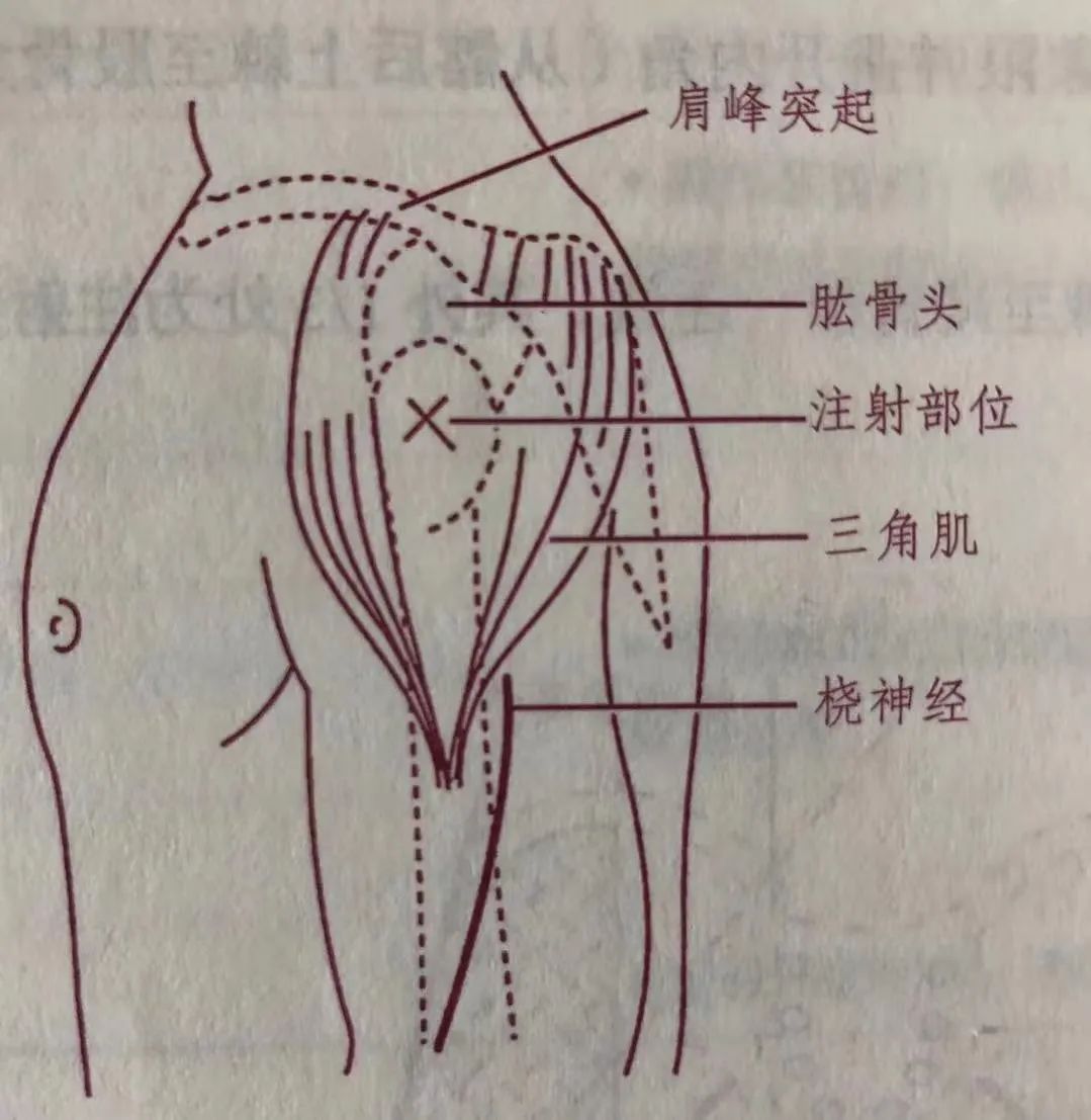 肌注回抽无回血拔针时有回血,肌注出现回血但是抽不动