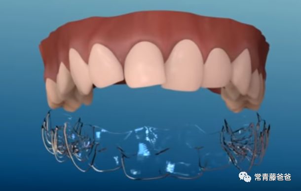 爱牙日保护你的口腔健康,爱牙日从定期口腔检查开始