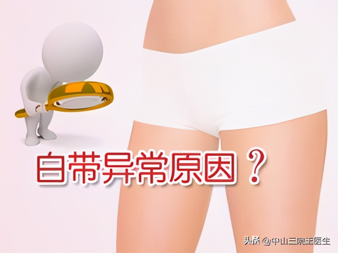白带健康的晴雨表是什么意思,白带是健康的晴雨表