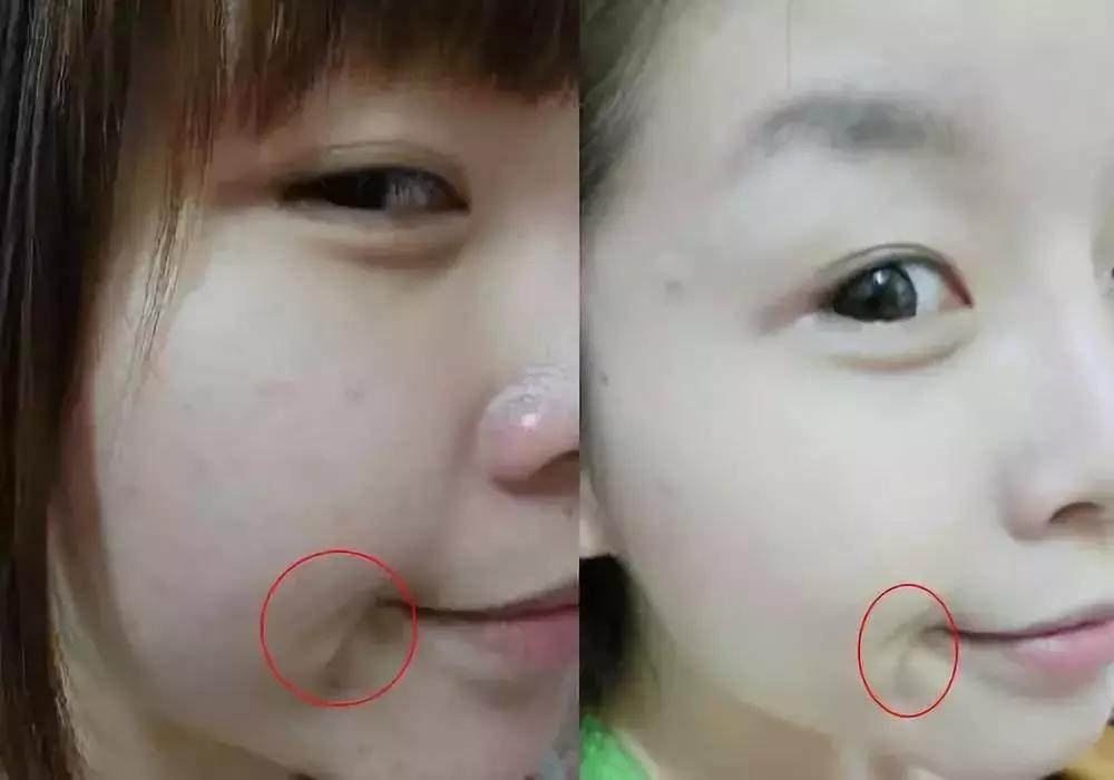 大创美白精华和雪肌精哪个好,大创美白精华